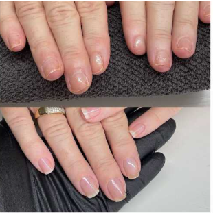 Customer testimonial before and after