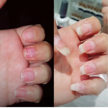 Customer testimonial before and after