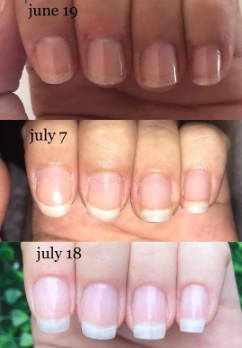 Customer testimonial before and after