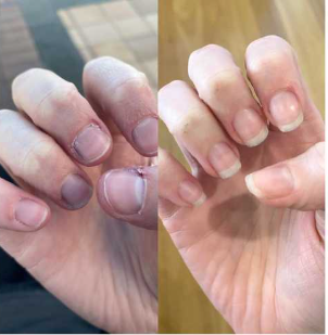 Customer testimonial before and after