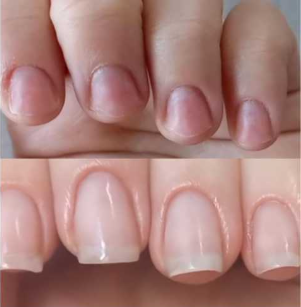Customer testimonial before and after