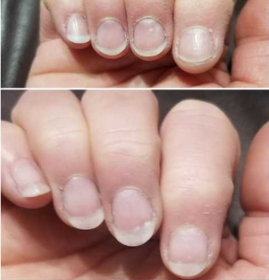 Customer testimonial before and after