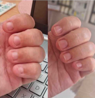 Customer testimonial before and after