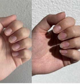 Customer testimonial before and after