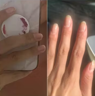 Customer testimonial before and after
