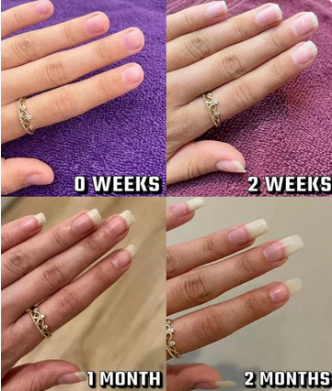 Customer testimonial before and after