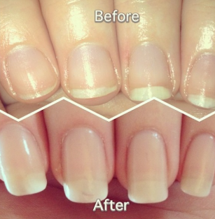 Customer testimonial before and after
