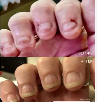 Customer testimonial before and after