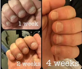 Customer testimonial before and after